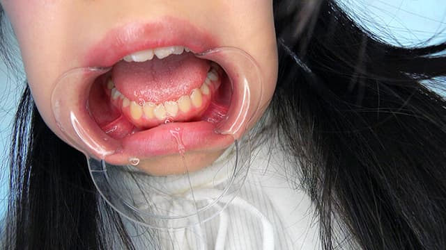 お嬢様は肉便器 生田りん ＃アナル ＃ゲロ ＃開口器 ＃ハードイラマチオ サンプル画像 12