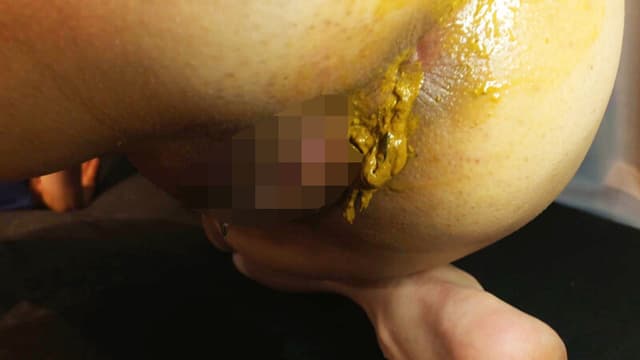汚物即配サービス 出前浣腸 志摩ことり サンプル画像 7