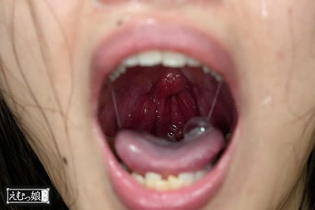 ステゴロ上等！強●パンプ嘔吐！長カテーテル3本刺し！喉をTKOされたい気高き総合イラマファイター KOHARU 三池小春 サンプル画像 10